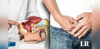 El cáncer de próstata es la primera causa de muerte de los hombres en Perú: ¿cómo prevenirlo?