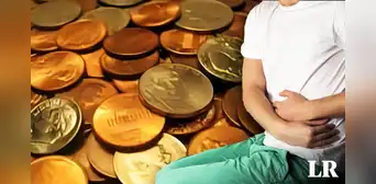 Hombre se salva de morir tras ingerir 39 monedas y 37 imanes: decía que "el zinc ayuda en el culturismo" Hombre se salva de morir tras ingerir 39 monedas y 37 imanes: decía que "el zinc ayuda en el culturismo"
