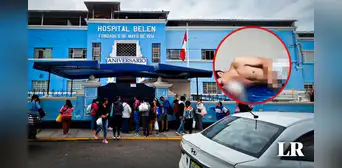 Trujillo: extorsionador pierde la mano al intentar detonar explosivo en casa de soldador Trujillo: extorsionador pierde la mano al intentar detonar explosivo en casa de soldador