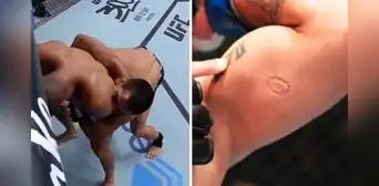 Luchador mordió a su rival, fue expulsado y el dueño de UFC regaló 50.000 dólares al afectado