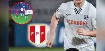 Peruano que milita en Europa sufrió fractura facial y se pierde el resto de la temporada Peruano que milita en Europa sufrió fractura facial y se pierde el resto de la temporada