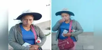 Madre necesita 70.000 soles para reconstruir rostro de su hijo, quien sufrió accidente en Arequipa Madre necesita 70.000 soles para reconstruir rostro de su hijo, quien sufrió accidente en Arequipa
