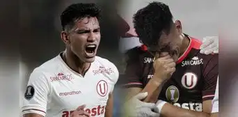 ¿Qué lesión tiene el 'Tunche' Rivera y cuántos partidos se perdería con Universitario?