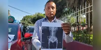 Arequipa: dueño de perro denuncia que veterinaria implantó perno de construcción en columna de mascota