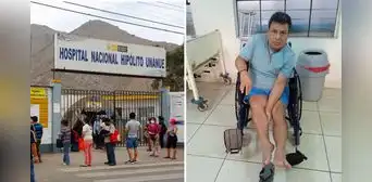 Vive en hospital más de 1 año: ingresó por fractura y terminó con hueso de pierna recortado Vive en hospital más de 1 año: ingresó por fractura y terminó con hueso de pierna recortado