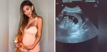 ¡Paula Manzanal está embarazada! Modelo anuncia que espera su segundo hijo