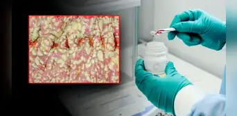 Conoce a MBK-01, la pastilla de heces fecales que reemplazará a los antibióticos contra infecciones graves