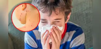 Perú en alerta por 'bacteria asesina' que alarmó a diversos países del mundo: ¿Cómo prevenirla y cuáles son sus síntomas? Perú en alerta por 'bacteria asesina' que alarmó a diversos países del mundo: ¿Cómo prevenirla y cuáles son sus síntomas?
