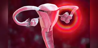 Científicos descubren método para detectar el cáncer de ovario 4 años antes de su diagnóstico Científicos descubren método para detectar el cáncer de ovario 4 años antes de su diagnóstico