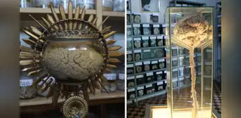 Conoce el museo más raro del Perú: está dentro de un hospital y la entrada solo cuesta S/5