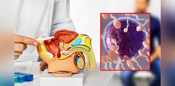 Eyacular al menos 21 veces al mes reduce el riesgo de padecer cáncer de próstata, según estudio de Harvard