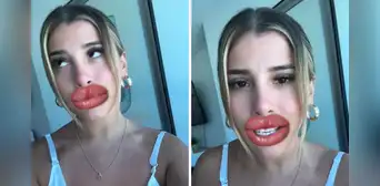 Yahaira Plasencia responde a quienes critican por su retoque estético y usuarios la apoyan: “Para que sigan hablando”