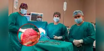 Médicos de Jaén extraen tumor gigante intraabdominal de un hombre: pesaba 12 kilos Médicos de Jaén extraen tumor gigante intraabdominal de un hombre: pesaba 12 kilos