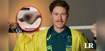 Se amputó el dedo para participar de los Juegos Olímpicos 2024 en París, conoce la historia de Matthew Dawson Se amputó el dedo para participar de los Juegos Olímpicos 2024 en París, conoce la historia de Matthew Dawson