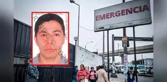 Hombre herido por caída de poste en plaza San Martín perdió una pierna tras accidente
