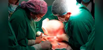 Adulta mayor de 61 años sobrevive a extracción de tumor de más 10kg en hospital de El Agustino