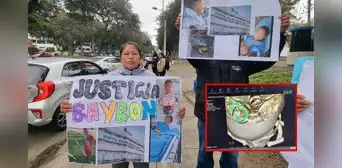VMT: menor de 6 años va al dentista y termina con una aguja en la cabeza en hospital de Essalud VMT: menor de 6 años va al dentista y termina con una aguja en la cabeza en hospital de Essalud