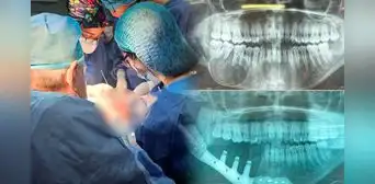Realizan el primer implante de titanio en mandíbula a paciente con tumor en el Perú: "Si me crecía iba ser peor" Realizan el primer implante de titanio en mandíbula a paciente con tumor en el Perú: "Si me crecía iba ser peor"