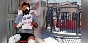 PJ ordena pago de medio millón de soles a favor de heladero que quedó desfigurado tras atropello en Arequipa PJ ordena pago de medio millón de soles a favor de heladero que quedó desfigurado tras atropello en Arequipa