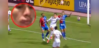 Así quedó el rostro del jugador de Melgar tras el codazo que recibió, por el que no cobraron penal