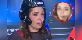 Yiddá Eslava REVELA que se fracturó la nariz luego de FUERTE golpe en 'EEG': "No puedo escapar de la operación"