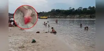 Ataque de pirañas en playa de Iquitos deja 10 heridos: biólogo advierte presencia por sequía de ríos Ataque de pirañas en playa de Iquitos deja 10 heridos: biólogo advierte presencia por sequía de ríos