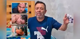Áncash: deshidratado y con signos de tortura fue rescatado empresario secuestrado Áncash: deshidratado y con signos de tortura fue rescatado empresario secuestrado