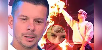 Mario Hart ALARMA al revelar que sufrió una FUERTE LESIÓN en el ojo: "Me clavé uno"