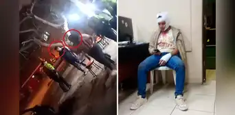Hermanos con camiseta de Universitario sufren brutal ataque en Los Olivos: sospechan de rivalidad entre barras