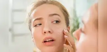 “Cara de cortisol”: la nueva tendencia viral que obsesiona a los usuarios de TikTok y preocupa a los médicos “Cara de cortisol”: la nueva tendencia viral que obsesiona a los usuarios de TikTok y preocupa a los médicos