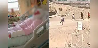 Profesor intenta prender antorcha por olimpiadas escolares en SJL y niña termina con graves quemaduras Profesor intenta prender antorcha por olimpiadas escolares en SJL y niña termina con graves quemaduras