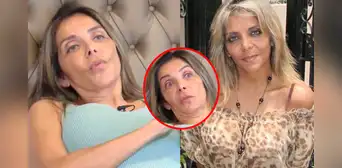Lucy Bacigalupo denuncia negligencia médica en el Rebagliatti tras operación en su columna: “La camilla se rompió y mi cuerpo fue al suelo”