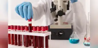 ¿Cómo saber qué tipo de sangre soy? Descubre a qué grupo sanguíneo perteneces y cuál es su significado ¿Cómo saber qué tipo de sangre soy? Descubre a qué grupo sanguíneo perteneces y cuál es su significado