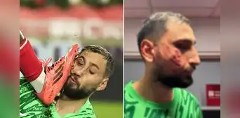 Donnarumma sufrió salvaje patada en el rostro y le pusieron 10 grapas: así quedó la cara del portero del PSG