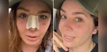 Yiddá Eslava comparte el resultado de su rinoplastia y explica por qué lo mantuvo en secreto: "Cambió mi vida" Yiddá Eslava comparte el resultado de su rinoplastia y explica por qué lo mantuvo en secreto: "Cambió mi vida"
