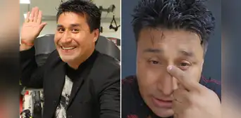 Danny Rosales postergó su operación de rinoplastia y explica que fue por "un problema personal"