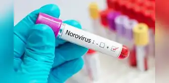 Cuáles son los síntomas del Norovirus y cómo prevenir su contagio en Estados Unidos Cuáles son los síntomas del Norovirus y cómo prevenir su contagio en Estados Unidos