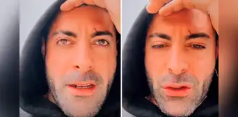 Sebastián Lizarzaburu muestra cicatrices en su rostro y conmueve con emotivo mensaje: “Días complicados” Sebastián Lizarzaburu muestra cicatrices en su rostro y conmueve con emotivo mensaje: “Días complicados”
