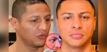 Jonathan Maicelo impacta a usuarios con radical cambio tras operación a la nariz: así luce ahora el boxeador