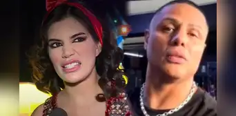 Samantha Batallanos sorprendida por resultado de operación a la nariz de Jonathan Maicelo: "No acepten canjes en la cara"