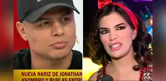 Jonathan Maicelo responde a Samantha Batallanos tras burlarse de su operación de nariz: “Contento con el resultado” Jonathan Maicelo responde a Samantha Batallanos tras burlarse de su operación de nariz: “Contento con el resultado”