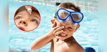 ¿Por qué la conjuntivitis aumenta en verano? Descubre las causas, cuánto dura y cómo curarla, según especialistas ¿Por qué la conjuntivitis aumenta en verano? Descubre las causas, cuánto dura y cómo curarla, según especialistas