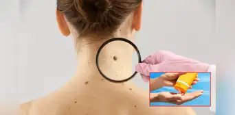 ¿Cómo proteger tu piel del sol y reducir el riesgo de cáncer? Dermatóloga peruana te brinda sus mejores recomendaciones ¿Cómo proteger tu piel del sol y reducir el riesgo de cáncer? Dermatóloga peruana te brinda sus mejores recomendaciones