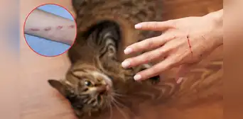 El insólito caso de la niña que casi muere por el arañazo de un gato: contrajo una grave y rara infección ósea