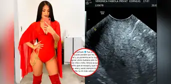 Verónica Privat, cantante de Alma Bella, anunció la pérdida de su bebé con emotiva publicación: “Te pido perdón”