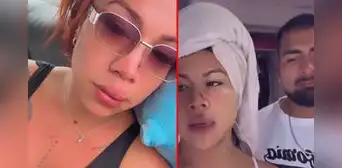 Dayanita niega que sus lesiones sean por una supuesta agresión de su novio: “Él tiene 12 puntos en su cabeza” Dayanita niega que sus lesiones sean por una supuesta agresión de su novio: “Él tiene 12 puntos en su cabeza”