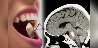 Científicos descubren que las bacterias que habitan en la boca podrían afectar a nuestro cerebro