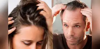 ¿Se te cae mucho el cabello? Estos son los alimentos que necesitas comer para fortalecerlo, según expertos