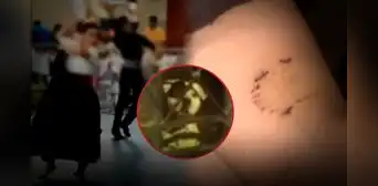 Bailaba marinera y ahora no puede moverse: perro ataca en la pierna a niña de 11 años en SMP Bailaba marinera y ahora no puede moverse: perro ataca en la pierna a niña de 11 años en SMP