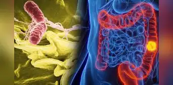 Científicos en China crean bacterias que podrían eliminar los tumores y generar inmunidad contra el cáncer Científicos en China crean bacterias que podrían eliminar los tumores y generar inmunidad contra el cáncer